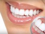 در مورد جراحی زیبایی دندان در ساری بیشتر بدانید