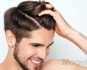 هر آنچه باید در مورد کاشت مو در یاسوج بدانید