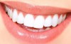 در مورد جراحی زیبایی دندان در قزوین بیشتر بدانید