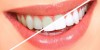 در مورد جراحی زیبایی دندان در کرمان بیشتر بدانید