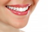در مورد جراحی زیبایی دندان در همدان بیشتر بدانید