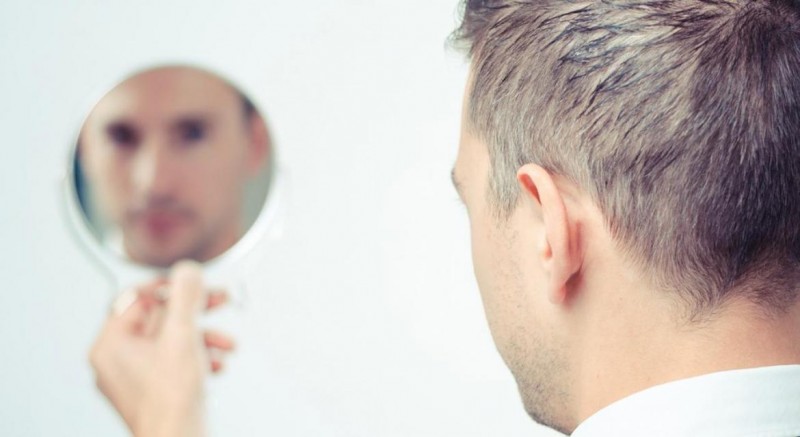 هر آنچه باید در مورد کاشت مو در اردبیل بدانید
