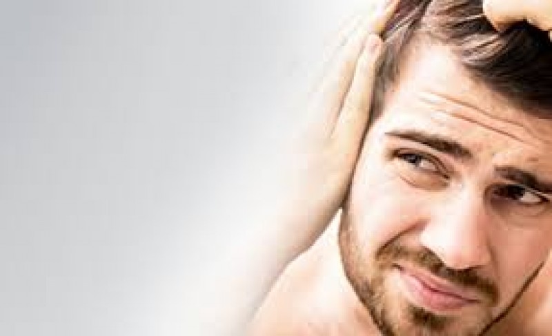 هر آنچه باید در مورد کاشت مو در ایلام بدانید