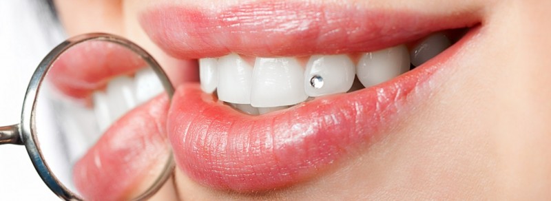در مورد جراحی زیبایی دندان در سمنان بیشتر بدانید