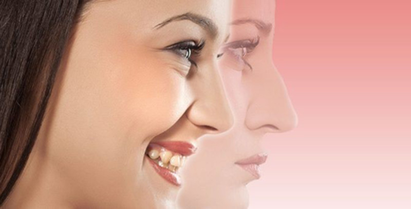 همه چیز در مورد جراحی زیبایی بینی در گرگان