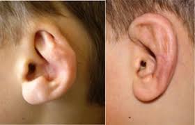 درمان مشکلات گوشها